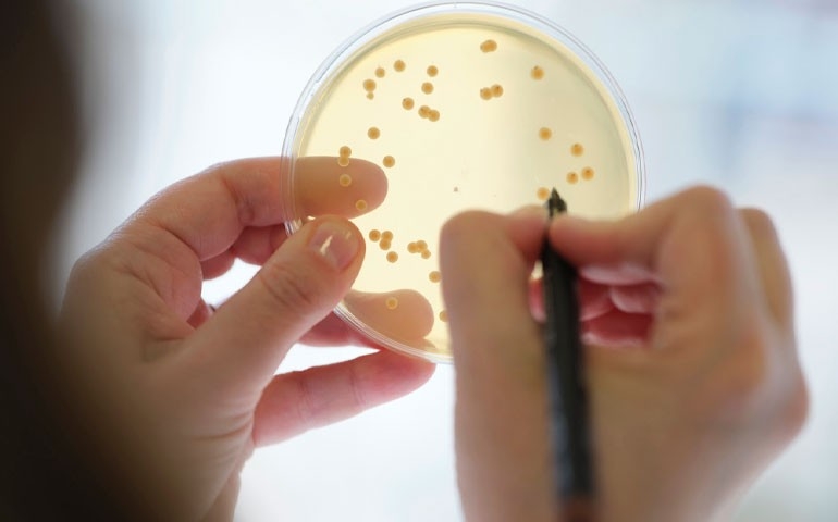 Evonik leva ao SIAVS 2026 soluções para a eficiência produtiva e a nutrição de precisão